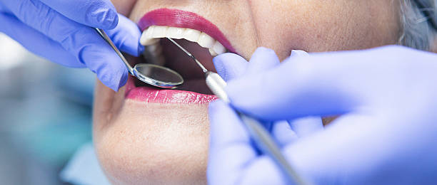 Best Root Canal Emergency Dentist  in Antelope, CA